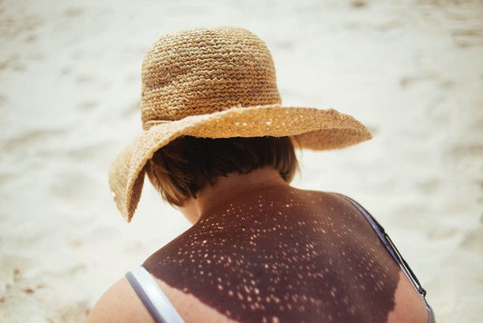 Sommerpflege mit festen Seifen - die richtige Pflege nach dem Sonnenbad Klar Seifen