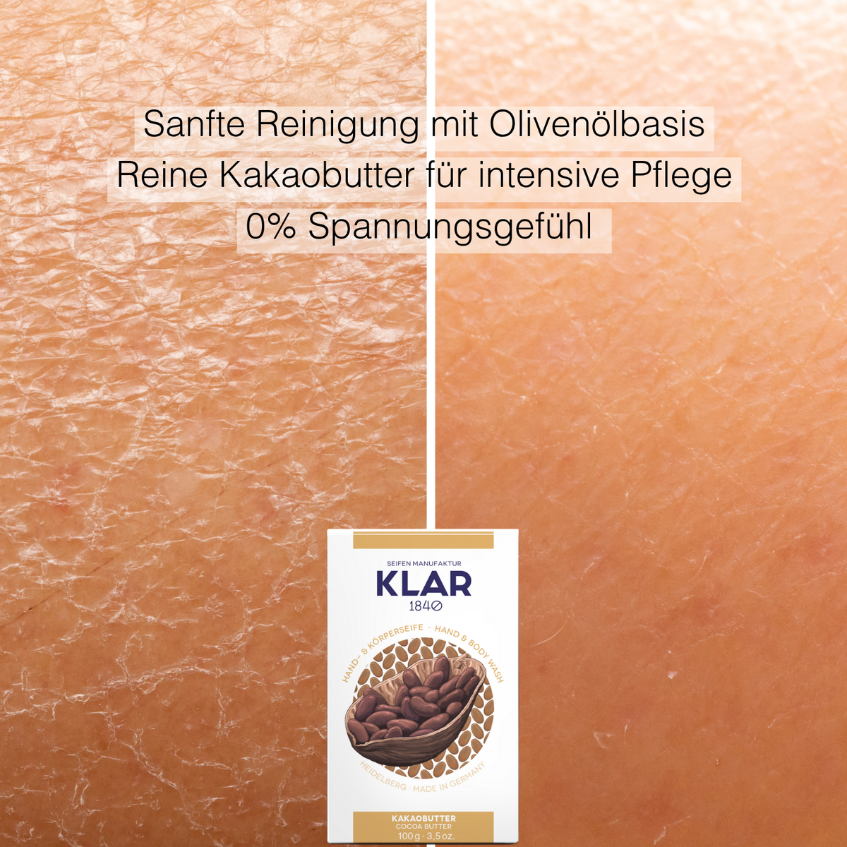 SOS Hilfe für Trockene Haut Klar Seifen