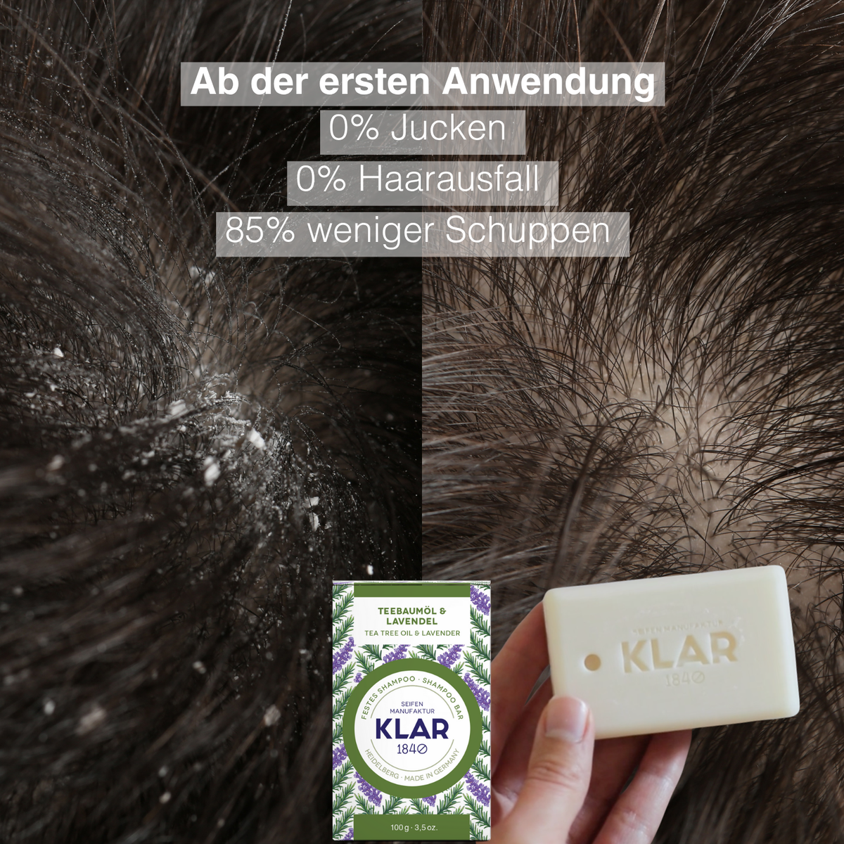 SOS Hilfe für Trockene Haut Klar Seifen
